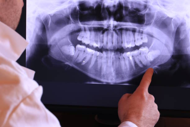 Best Emergency Root Canal Therapy in Oglethorpe, GA